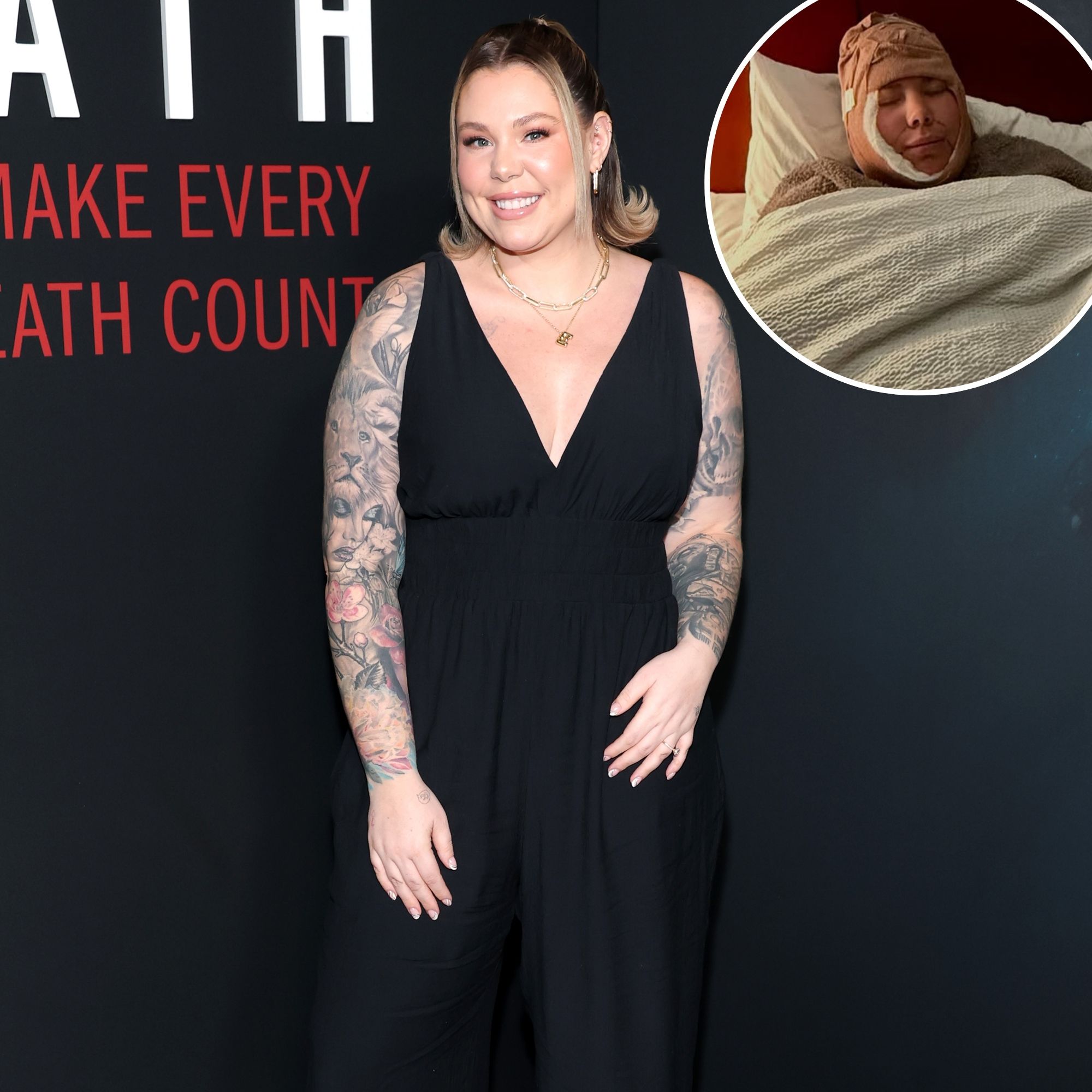 Kailyn Lowry Plastic Surgery