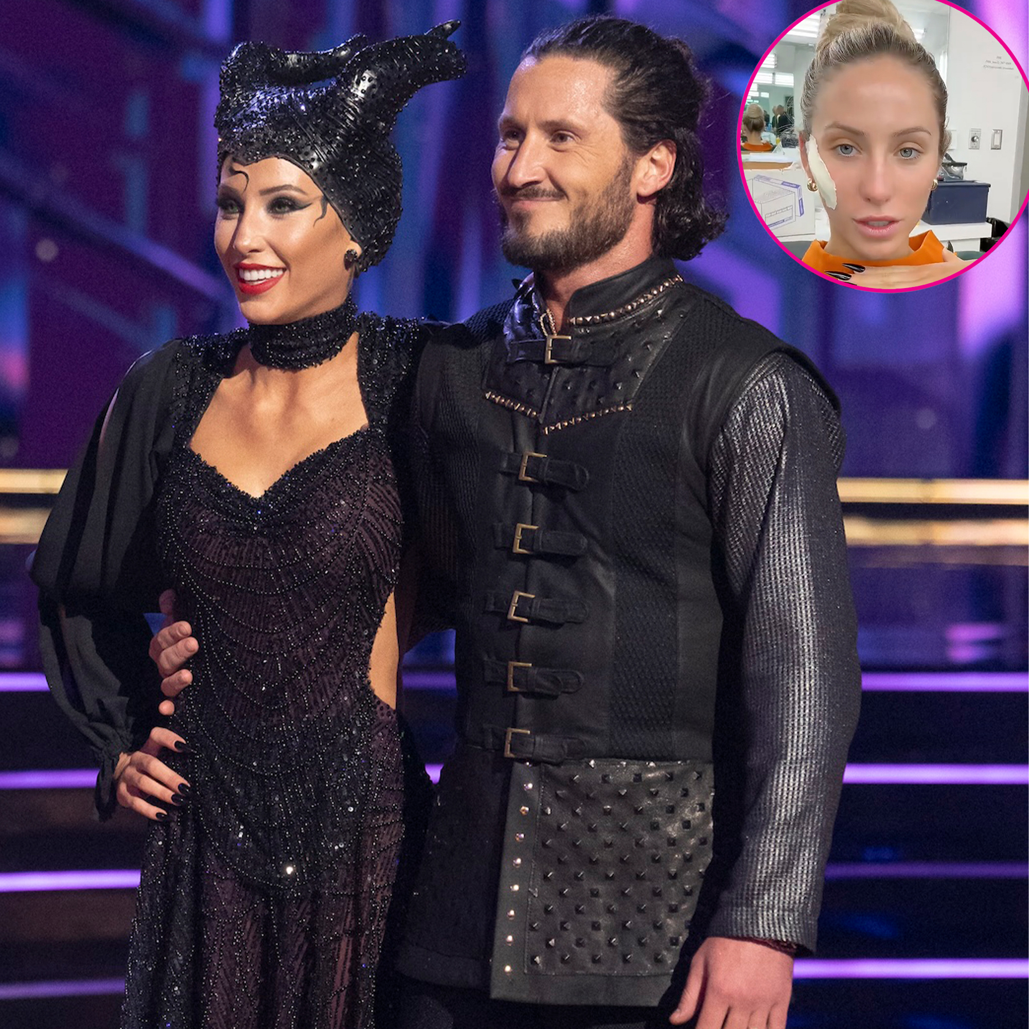 Alix Earle Explains Why She Removed Her Prosthetic Cheeks on DWTS