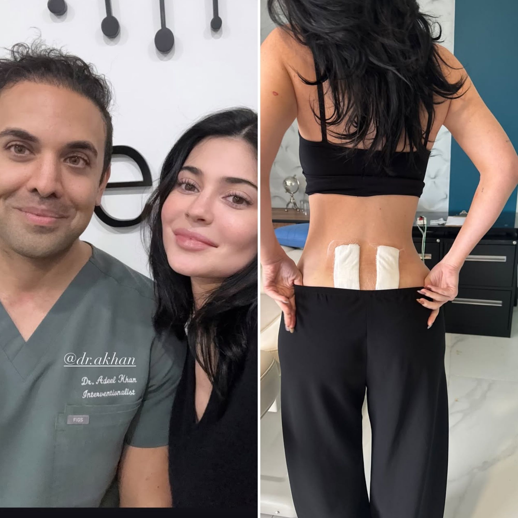 Kylie Jenner Undergoes Stem Cell Therapy for 'Chronic Back Pain'