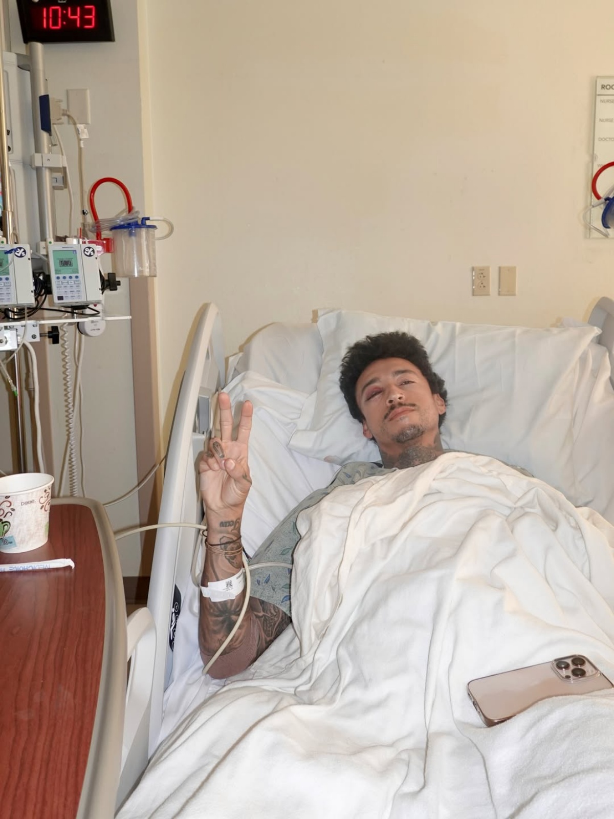 Olympic Skateboarder Nyjah Huston Suffers Fractured Skull After Death Defying Stunt