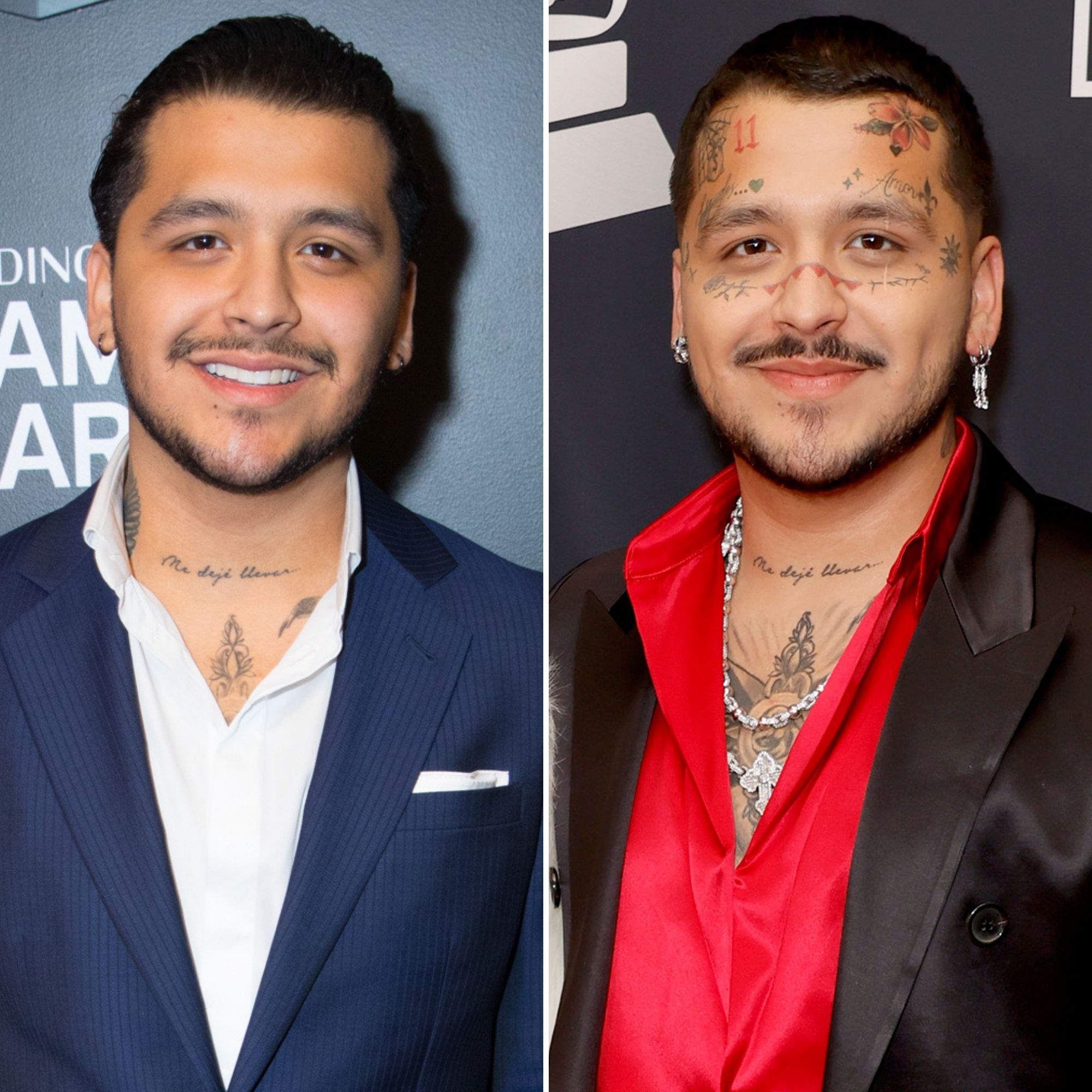 Christian Nodal borra los tatuajes de su rostro.