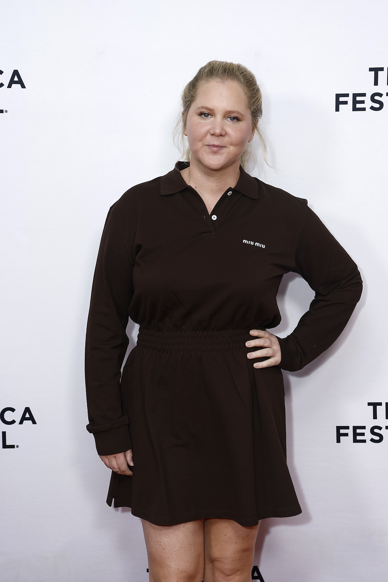 Amy Schumer Quotes on Weight Loss and Body Image GettyImages-2220191454