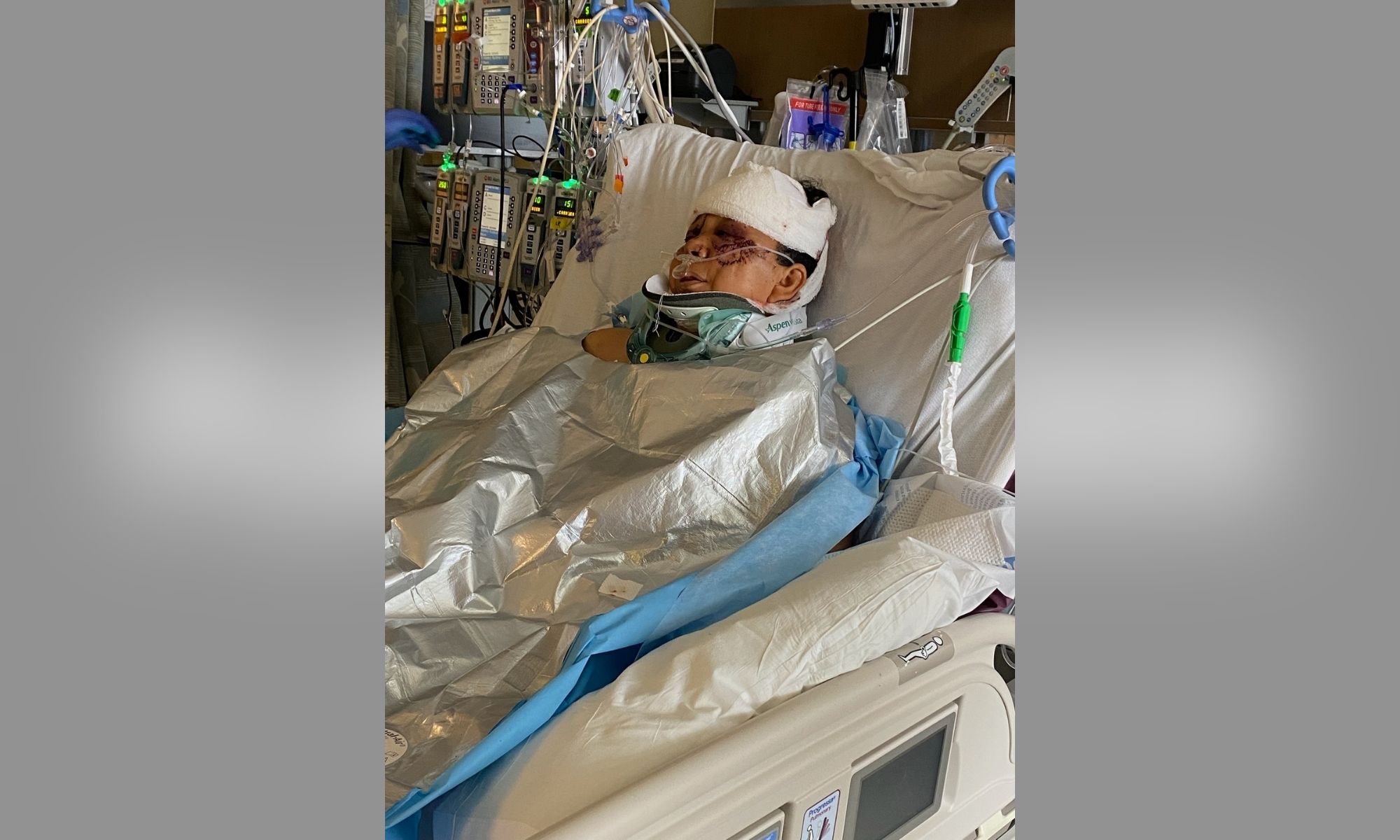 Colorado Woman Left in Critical Condition After Being Attacked By 3 Dogs Outside of Her Home