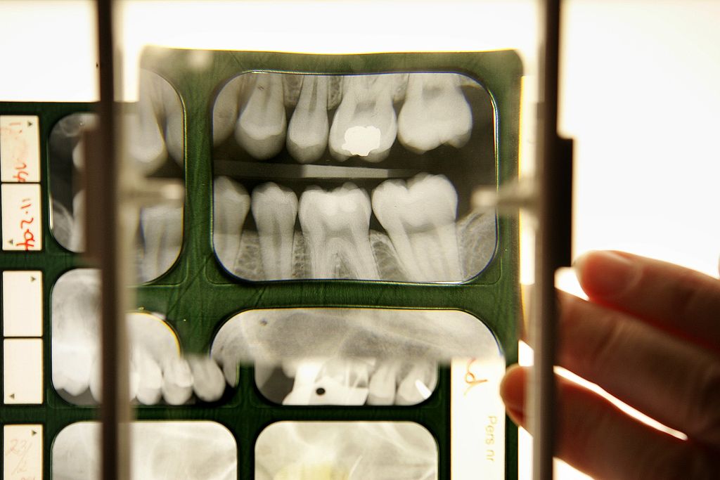 GettyImages-57371825 New Study Finds Anti-Aging Drugs Just Reversed Tooth Decay