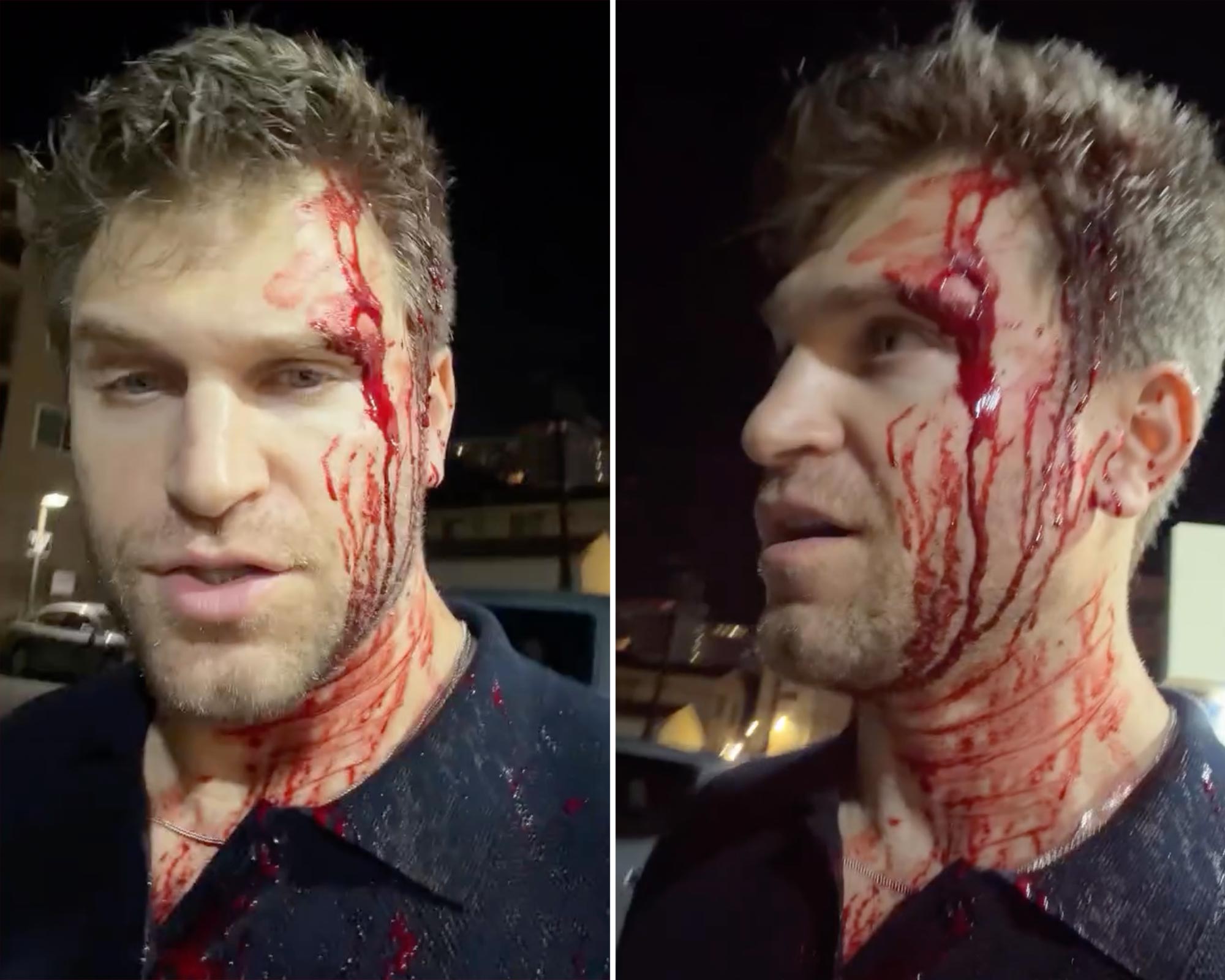 Keegan Allen Robbed at Gunpoint