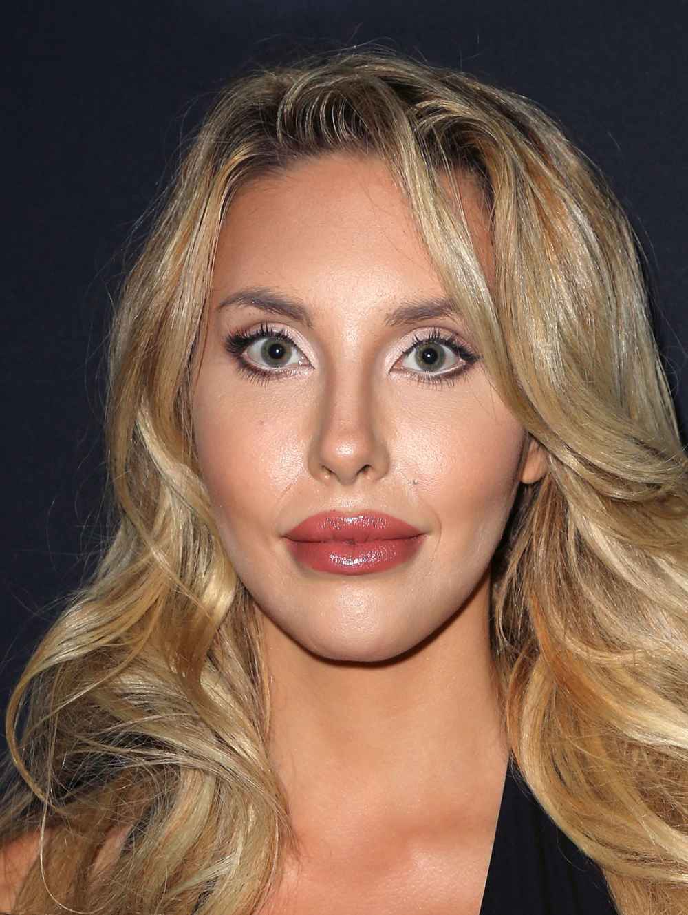 Chloe Lattanzi says she's had her lip injections removed