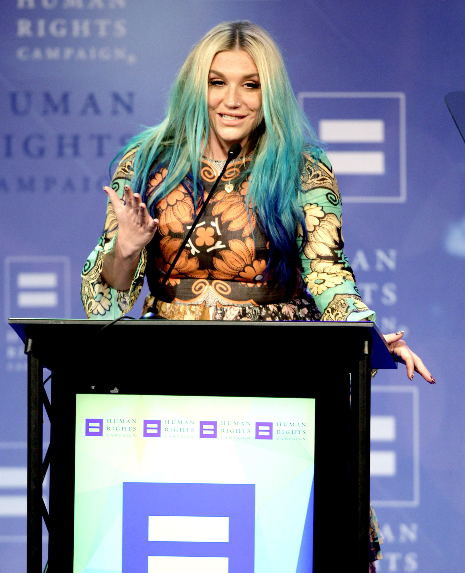 Kesha
